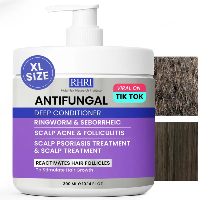 Conditionneur Profond Antifongique pour Hommes et Femmes | Soin Cuir Chevelu – Psoriasis, Pellicules & Dermatite Séborrhéique