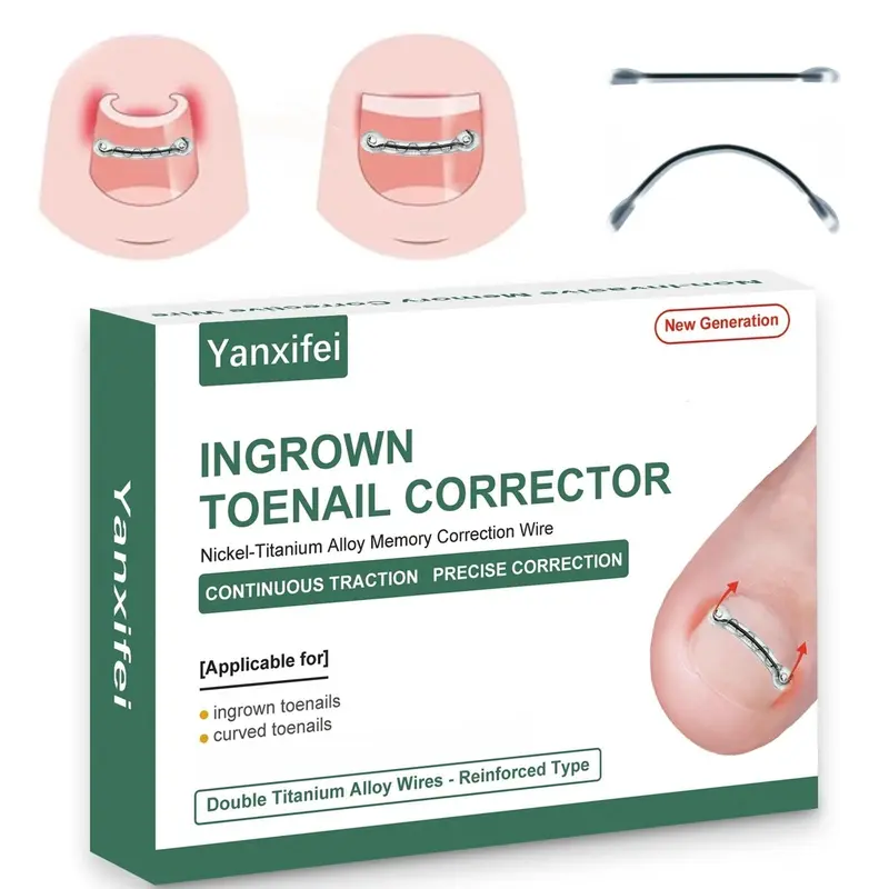 Correcteur d’ongle incarné en Nitinol Double Yanxifei – Redressement d’ongle incurvé (0,55 po, 0,66 po)