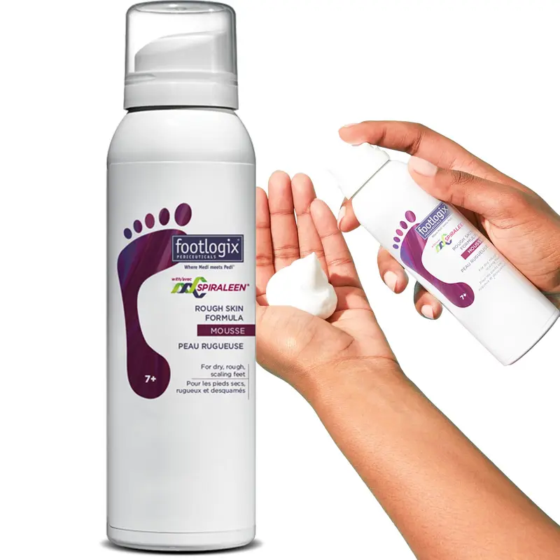 Footlogix Mousse Callosités et Peau Seche – Spiraleen, Hydratation Profonde, 4.23 oz