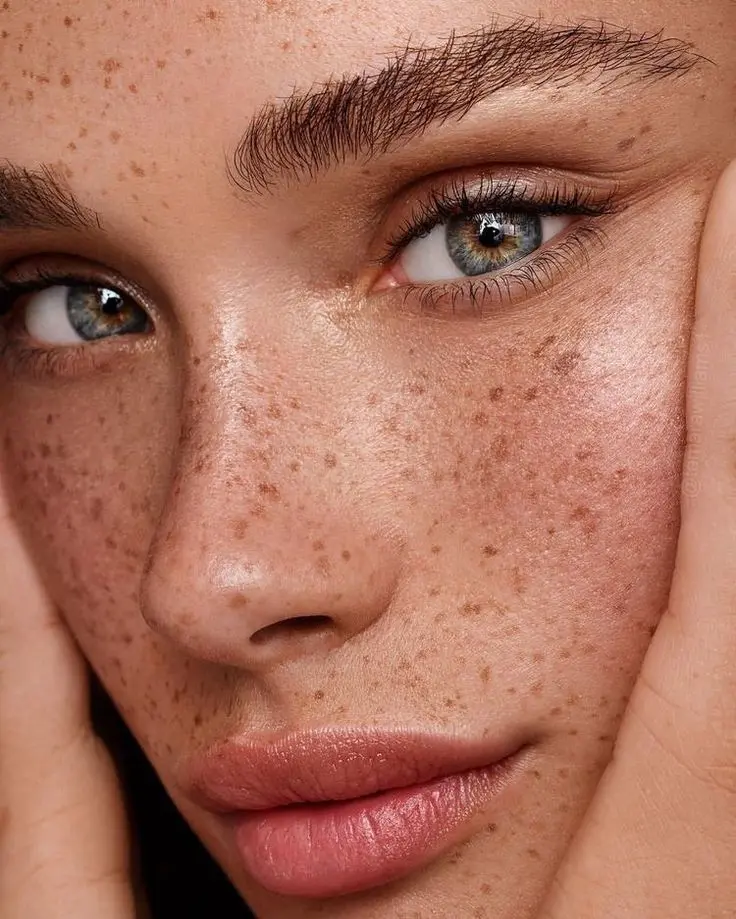 FORMATION FRECKLES / TÂCHES DE ROUSSEUR - 1 JOUR