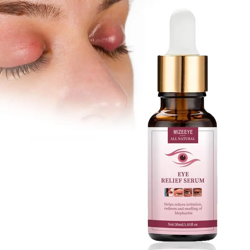 MIZEEYE Sérum Soin Yeux — Hydratant paupières, 30ml, Doux pour blepharite et chalazion