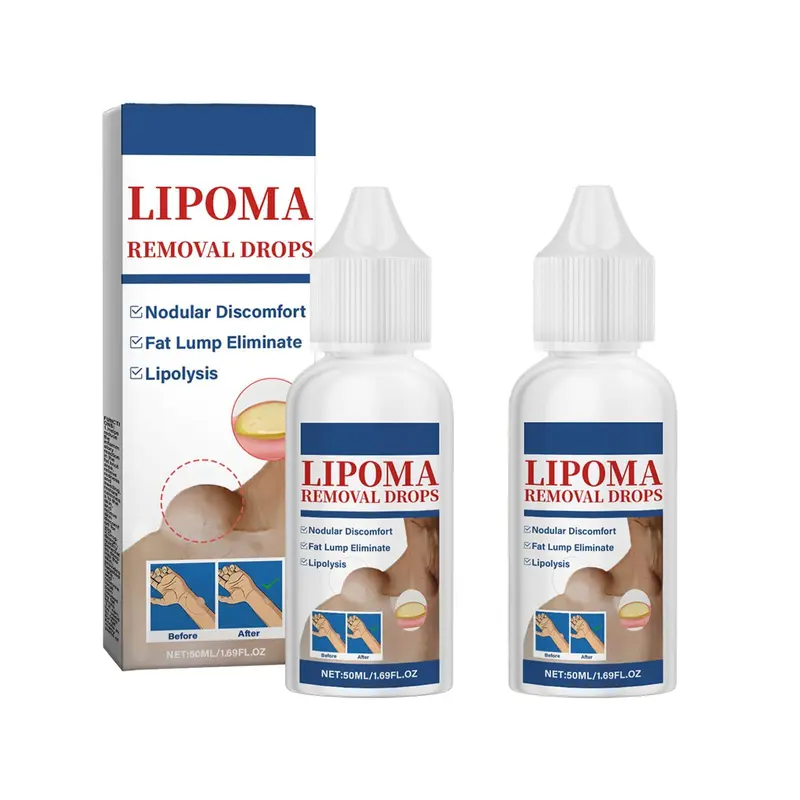 RCSCBC Gouttes à base de plantes pour lipomes – Soin peau lipome, 50 ml / 1,69 oz (2 pièces)
