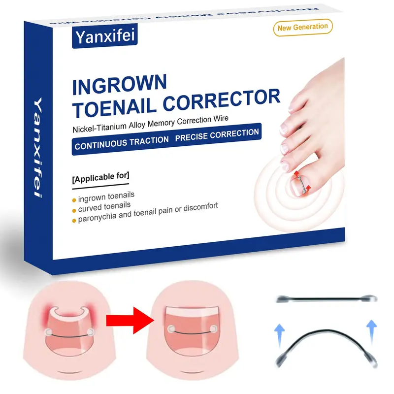 Yanxifei Correcteur d’ongle incarné en Nitinol – Traitement à domicile (11/16 po, 13/16 po)