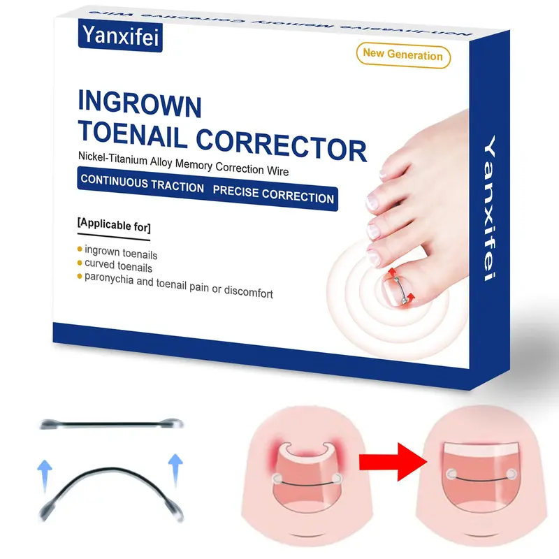 Yanxifei – Correcteur d’Ongle Incarné en Nitinol, Usage à Domicile, Ongle Courbé Aligné (Kit 1/2 po, 11/16 po)